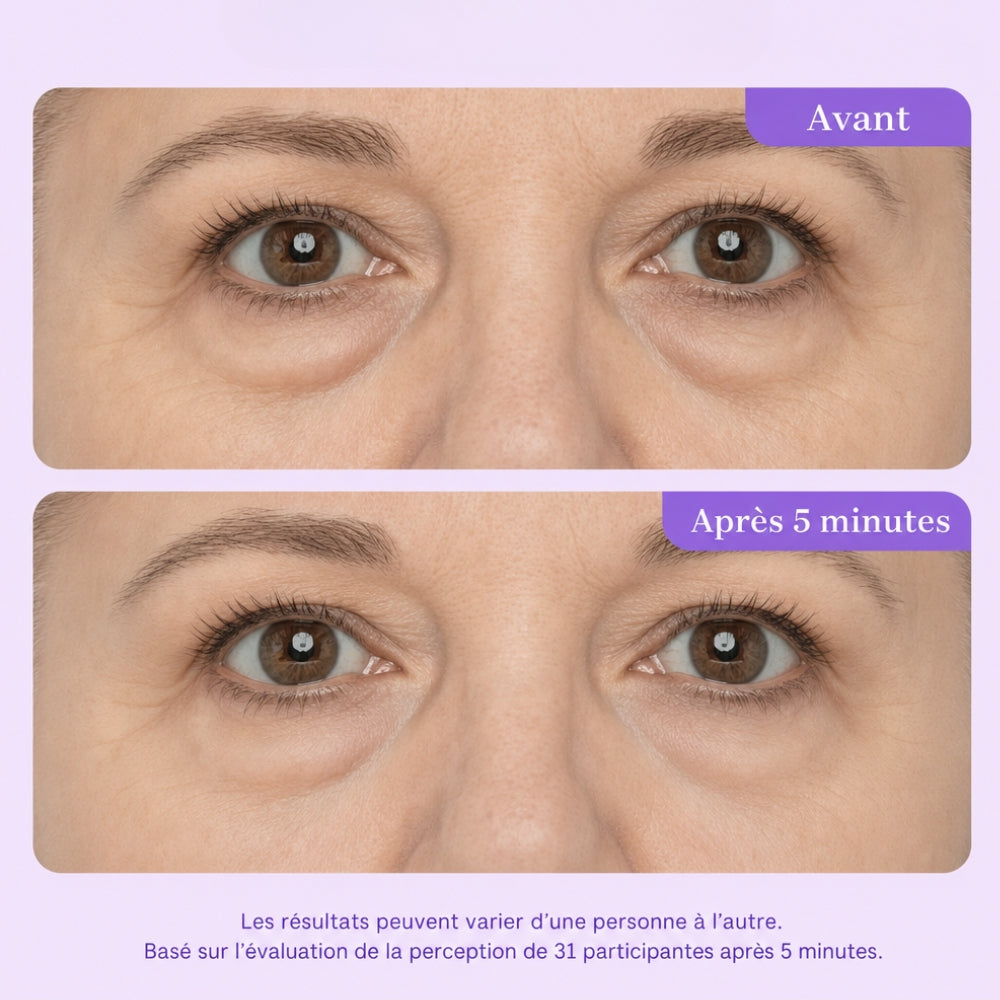 Qeloral Contour Yeux — Effet Lift en 5 Minutes