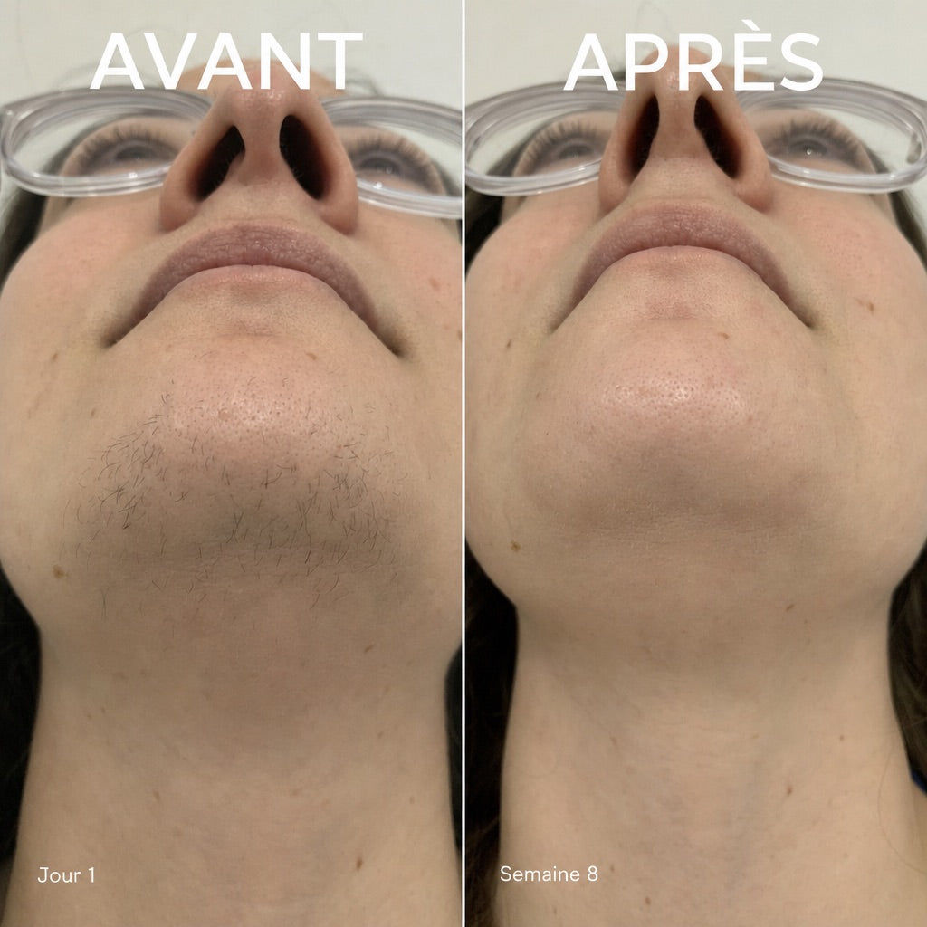 Qeloral Serum Anti-Repousse
