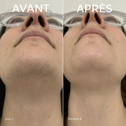 Qeloral Serum Anti-Repousse
