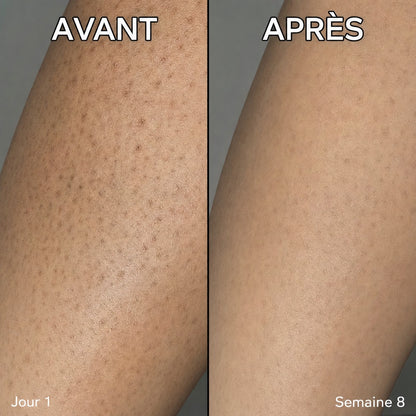 Qeloral Serum Anti-Repousse