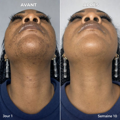 Qeloral Serum Anti-Repousse
